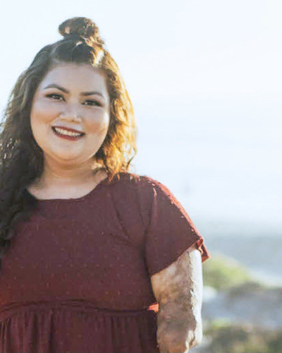 Story of Hope: Meet Andrea