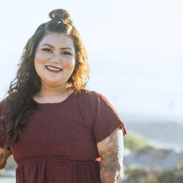 Story of Hope: Meet Andrea